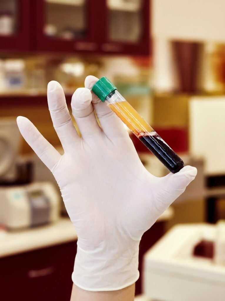 prp 3