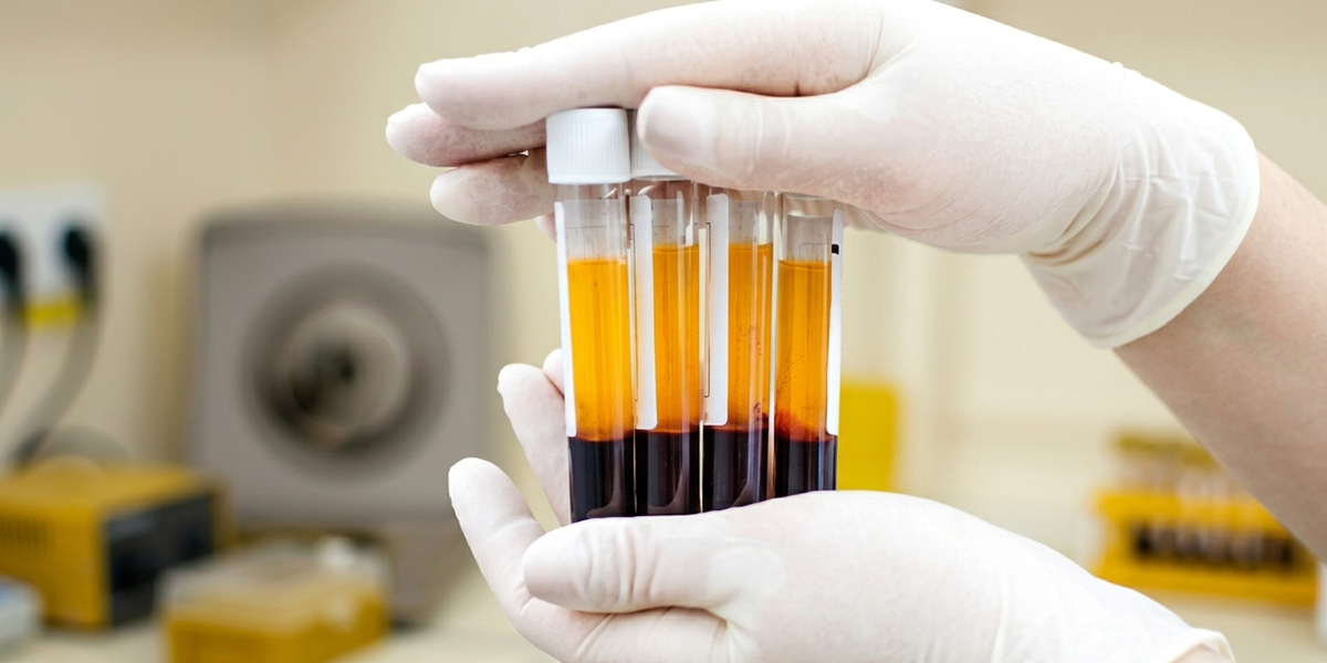 1200x600 prp therapy 2
