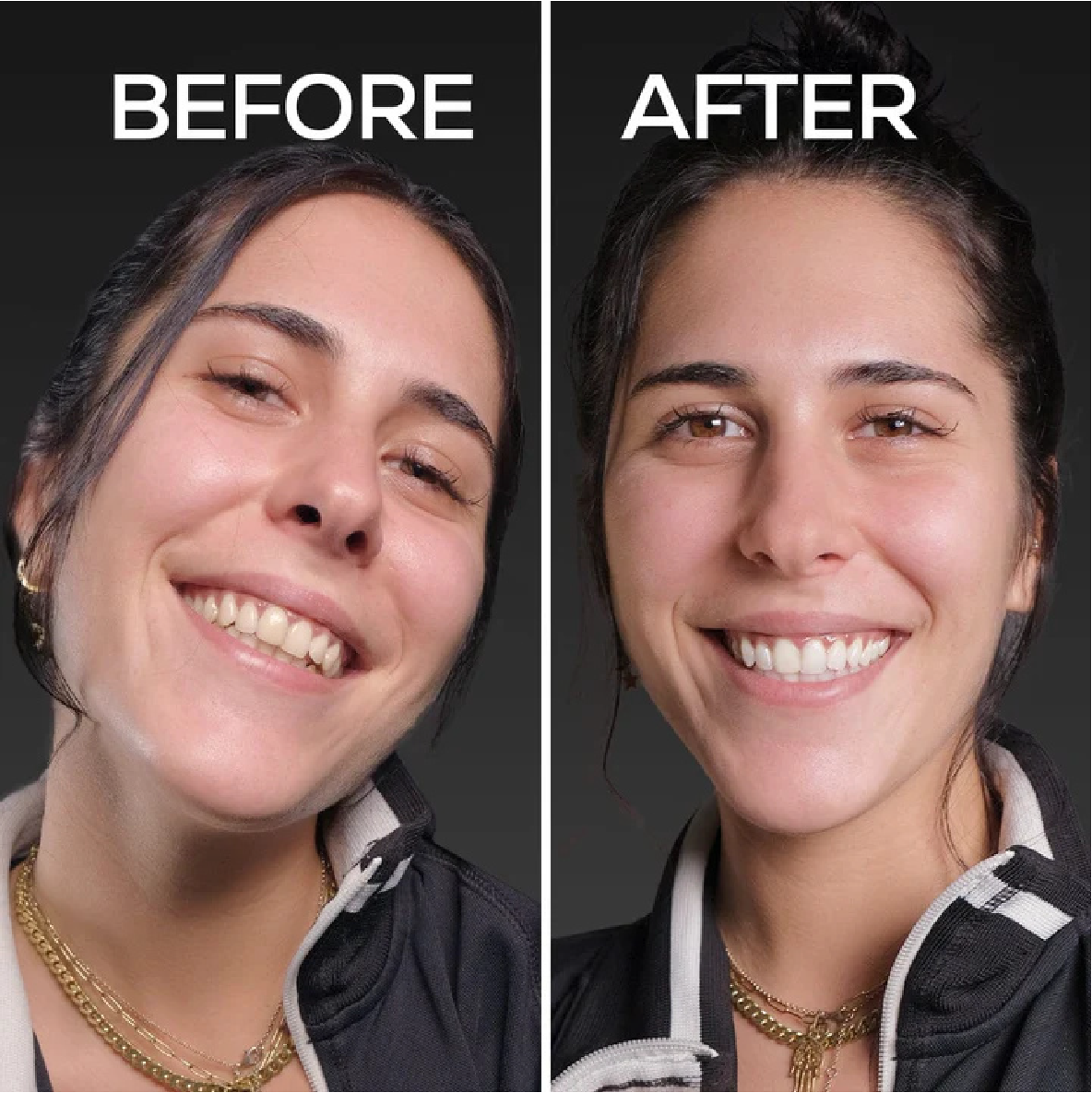 glo science before after